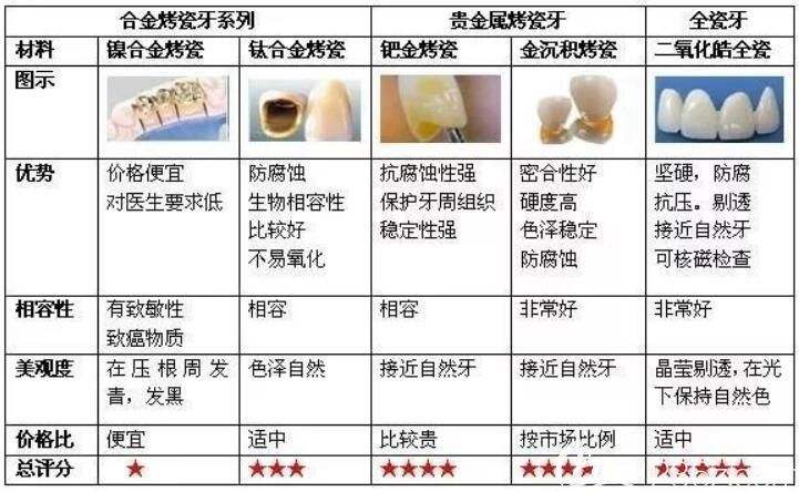 最新镶牙技术观点论述与介绍
